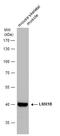 LIM Homeobox Transcription Factor 1 Beta antibody, GTX129831, GeneTex, Western Blot image 