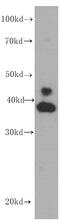 Erk1 antibody, FNab02847, FineTest, Western Blot image 