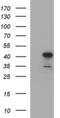 HAUS Augmin Like Complex Subunit 7 antibody, MA5-26313, Invitrogen Antibodies, Western Blot image 