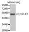Cyclin E1 antibody, abx000559, Abbexa, Western Blot image 
