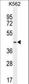 TATA-Box Binding Protein Like 2 antibody, LS-C161749, Lifespan Biosciences, Western Blot image 