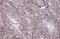 Snail Family Transcriptional Repressor 1 antibody, GTX100754, GeneTex, Immunohistochemistry paraffin image 