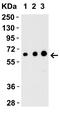 Epstein-Barr Virus Induced 3 antibody, A07190-1, Boster Biological Technology, Western Blot image 