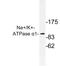 ATPase Na+/K+ Transporting Subunit Alpha 1 antibody, LS-C177335, Lifespan Biosciences, Western Blot image 