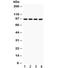 Solute Carrier Family 6 Member 4 antibody, R32066, NSJ Bioreagents, Western Blot image 