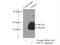 Squalene synthase antibody, 13128-1-AP, Proteintech Group, Immunoprecipitation image 