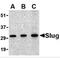 Snail Family Transcriptional Repressor 2 antibody, TA306361, Origene, Western Blot image 