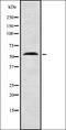 Rho GTPase-activating protein 1 antibody, orb378228, Biorbyt, Western Blot image 