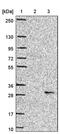 Sorting Nexin 24 antibody, PA5-60752, Invitrogen Antibodies, Western Blot image 