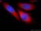 Son of sevenless homolog 1 antibody, 55041-1-AP, Proteintech Group, Immunofluorescence image 