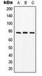 Solute Carrier Family 15 Member 1 antibody, orb214585, Biorbyt, Western Blot image 