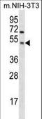 Glycogen Synthase Kinase 3 Alpha antibody, LS-C164395, Lifespan Biosciences, Western Blot image 