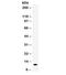 C-C Motif Chemokine Ligand 5 antibody, R31958, NSJ Bioreagents, Western Blot image 