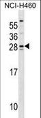 SH3 Domain Binding Glutamate Rich Protein antibody, LS-C169059, Lifespan Biosciences, Western Blot image 