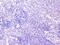 Cortactin antibody, A01253-1, Boster Biological Technology, Immunohistochemistry paraffin image 