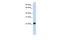 ADP Ribosylation Factor Like GTPase 8A antibody, A12318, Boster Biological Technology, Western Blot image 