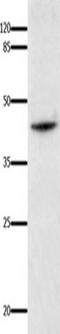 Interleukin 18 Binding Protein antibody, TA323374, Origene, Western Blot image 