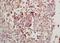 Ribosomal Protein S6 Kinase B1 antibody, orb11217, Biorbyt, Immunohistochemistry paraffin image 