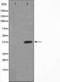 NFKB Inhibitor Alpha antibody, TA325728, Origene, Western Blot image 