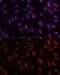 Homeobox B1 antibody, GTX33246, GeneTex, Immunocytochemistry image 