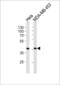 Calponin 1 antibody, MBS9207960, MyBioSource, Western Blot image 