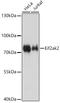 Eukaryotic Translation Initiation Factor 2 Alpha Kinase 2 antibody, GTX53983, GeneTex, Western Blot image 