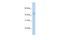 Protein Arginine Methyltransferase 8 antibody, A07980, Boster Biological Technology, Western Blot image 