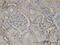 Calmodulin Like 5 antibody, H00051806-M16, Novus Biologicals, Immunohistochemistry paraffin image 