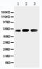 Kin17 DNA And RNA Binding Protein antibody, LS-C313337, Lifespan Biosciences, Western Blot image 