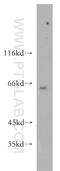 Cyclin Dependent Kinase 19 antibody, 13761-1-AP, Proteintech Group, Western Blot image 