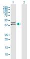 Protein Phosphatase, Mg2+/Mn2+ Dependent 1K antibody, H00152926-B01P, Novus Biologicals, Western Blot image 