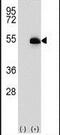 Alpha-L-Fucosidase 2 antibody, PA5-14672, Invitrogen Antibodies, Western Blot image 