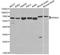 Karyopherin Subunit Alpha 1 antibody, A1742, ABclonal Technology, Western Blot image 