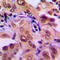 Mitogen-Activated Protein Kinase Kinase 1 antibody, LS-C352744, Lifespan Biosciences, Immunohistochemistry paraffin image 