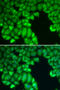 Caspase 10 antibody, STJ22895, St John