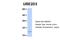 Ubiquitin Conjugating Enzyme E2 D3 antibody, NBP1-55276, Novus Biologicals, Western Blot image 