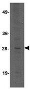 Killer cell lectin-like receptor 3 antibody, GTX31969, GeneTex, Western Blot image 