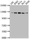 ATP Citrate Lyase antibody, CSB-RA712206A0HU, Cusabio, Western Blot image 