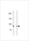 Semaphorin 6B antibody, LS-C203997, Lifespan Biosciences, Western Blot image 