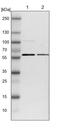 Glycerol-3-Phosphate Acyltransferase 4 antibody, PA5-53428, Invitrogen Antibodies, Western Blot image 