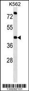 Purinergic Receptor P2X 2 antibody, 58-201, ProSci, Western Blot image 
