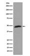 Aurora Kinase A antibody, M00246, Boster Biological Technology, Western Blot image 