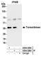 Transaldolase 1 antibody, A304-326A, Bethyl Labs, Immunoprecipitation image 