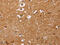 CD38 Molecule antibody, CSB-PA926996, Cusabio, Immunohistochemistry frozen image 