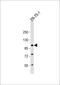 Folate Hydrolase 1 antibody, 57-212, ProSci, Western Blot image 