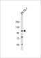 Naalad1 antibody, 57-212, ProSci, Western Blot image 