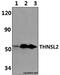 Threonine Synthase Like 2 antibody, A11597, Boster Biological Technology, Western Blot image 