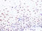 Small Ubiquitin Like Modifier 2 antibody, GTX02850, GeneTex, Immunohistochemistry paraffin image 