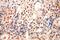 Taspase 1 antibody, 16739-1-AP, Proteintech Group, Immunohistochemistry paraffin image 