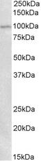 Homeobox C6 antibody, 43-397, ProSci, Western Blot image 